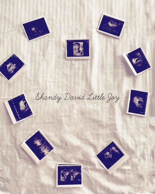 Foto-foto hasil USG buah hati Shandy Aulia