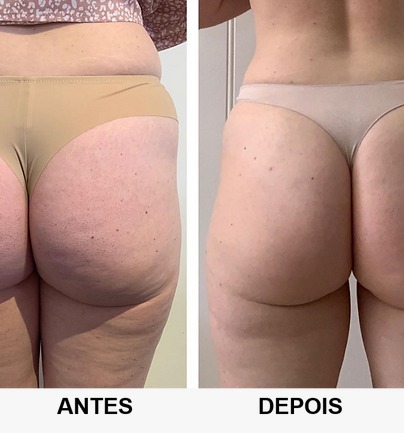 Projeto 4