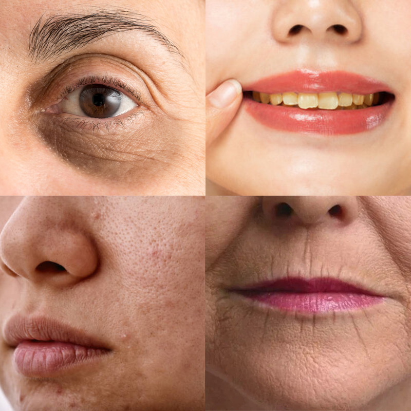 Skin problems caused by smoking