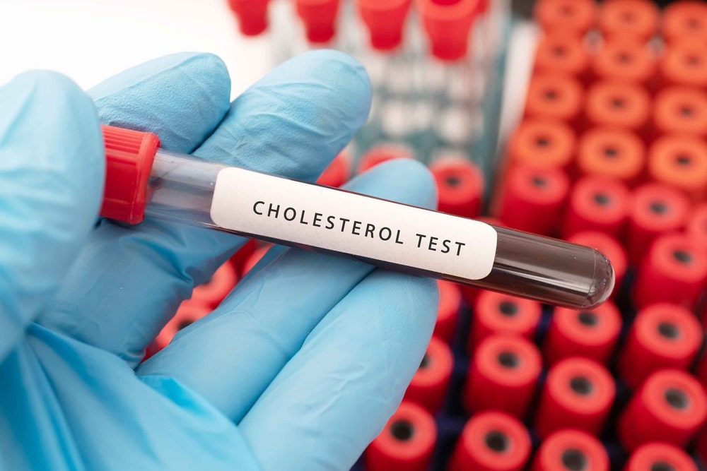 Cholesterol