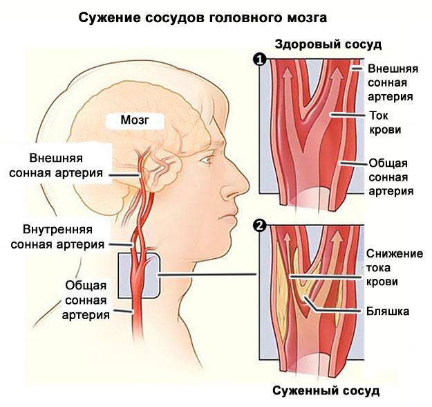 [Изображение: e6fa00d138df43d23c366af5d0de66cc.jpg]