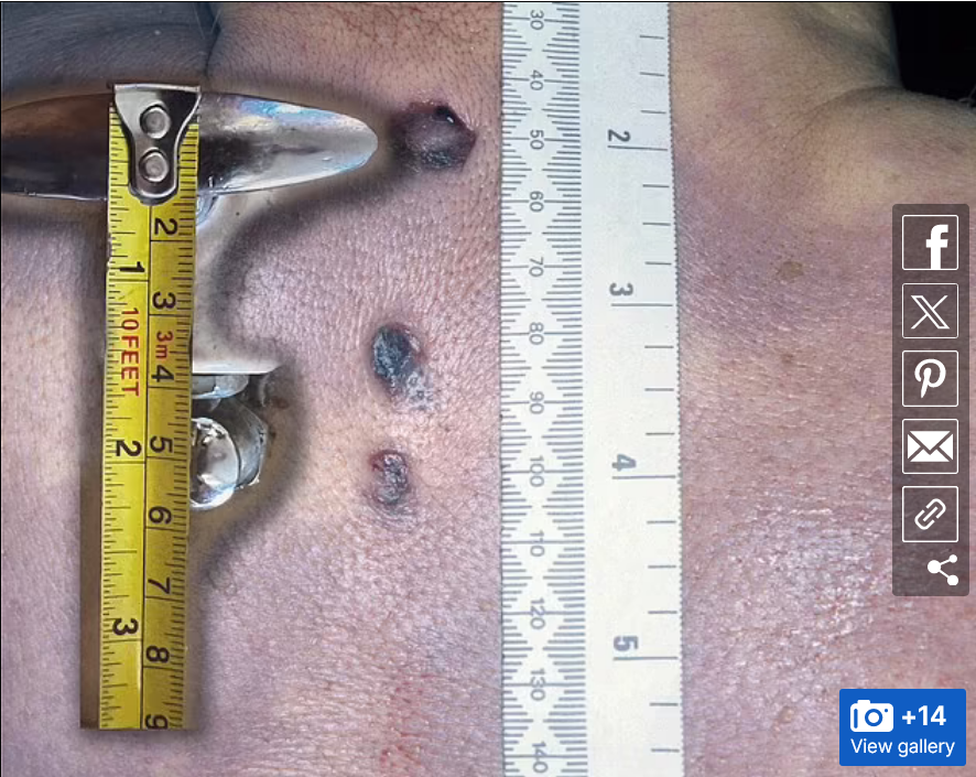 Forensic expert used PIG SKIN to test theory about Jeremy Bamber case (2)