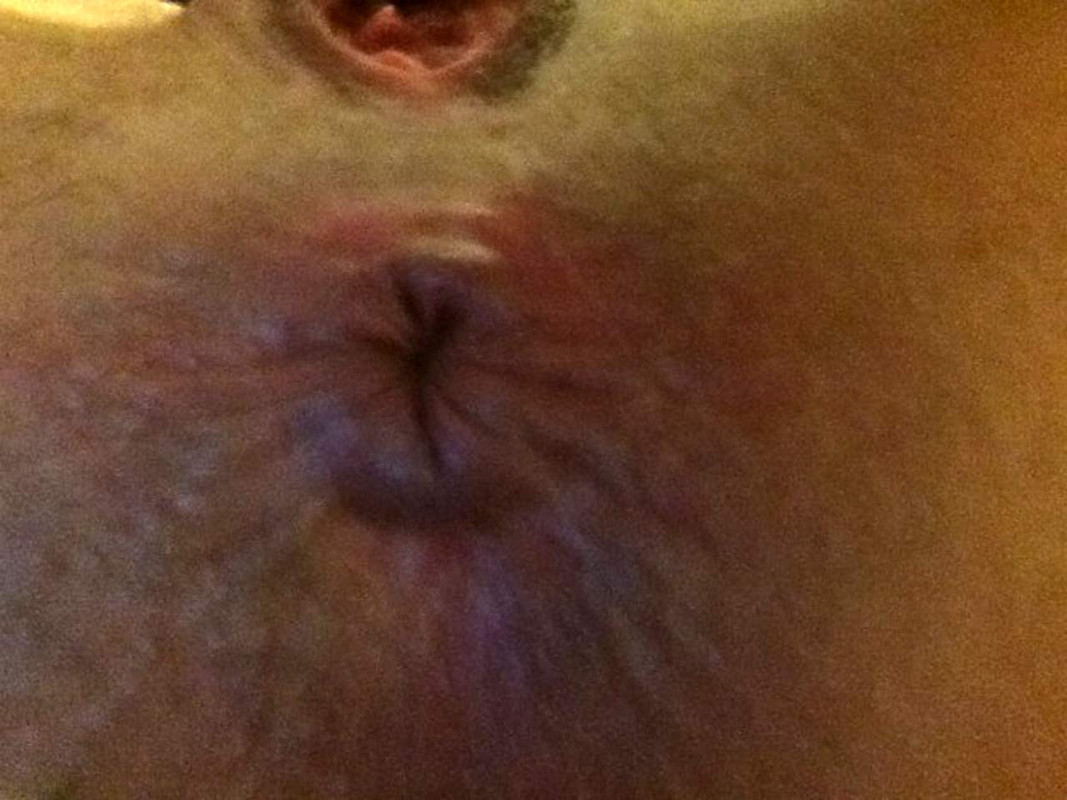 Hope-Solo-nude-leaked-naked-sexy-pussy-nipples-asshole-Scandal-Planet11-optimized