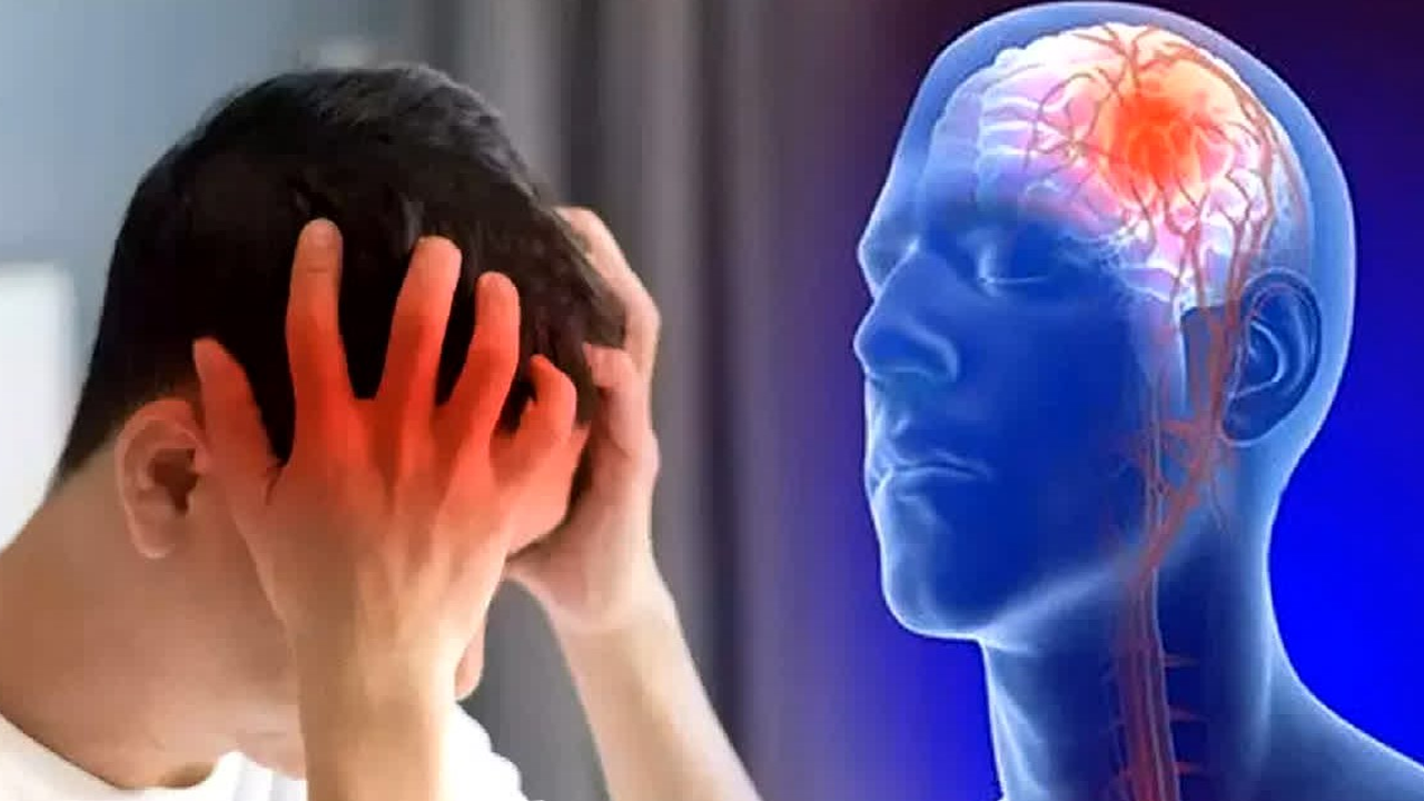 Mengenal Pecah Pembuluh Darah yang Menimpa Titiek Puspa