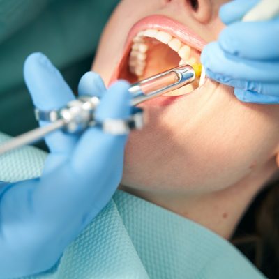 Laboratorio protesico certificato per impianti dentali
