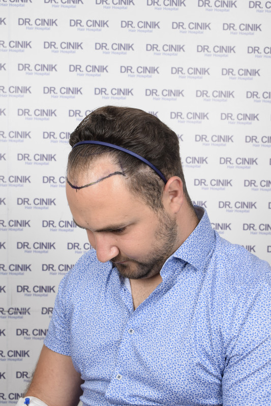 photos préopératoires (3)