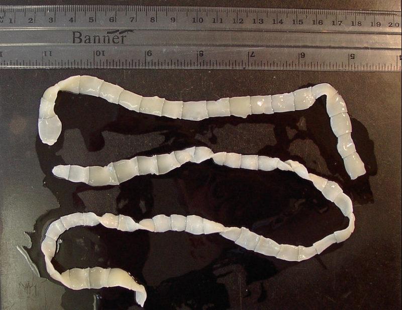 https://i.postimg.cc/gJJG6hkc/entochnye-chervi-u-cheloveka-simptomy-2-e1484742419866.jpg