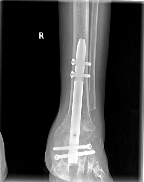 3FA1355A-F2CC-40E6-8E28-3EB5A25C24F2