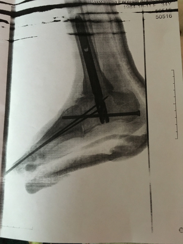 FA7EB6AC-4F4D-4E2B-92F8-28F9E1B8946D