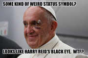 Pope black eye