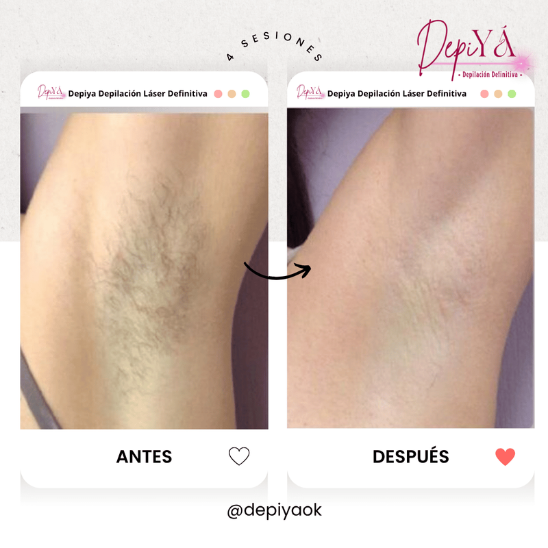 Antes y después 2
