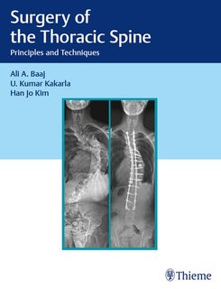 Surgery of the Thoracic Spine Principles and Techniques (EPUB)