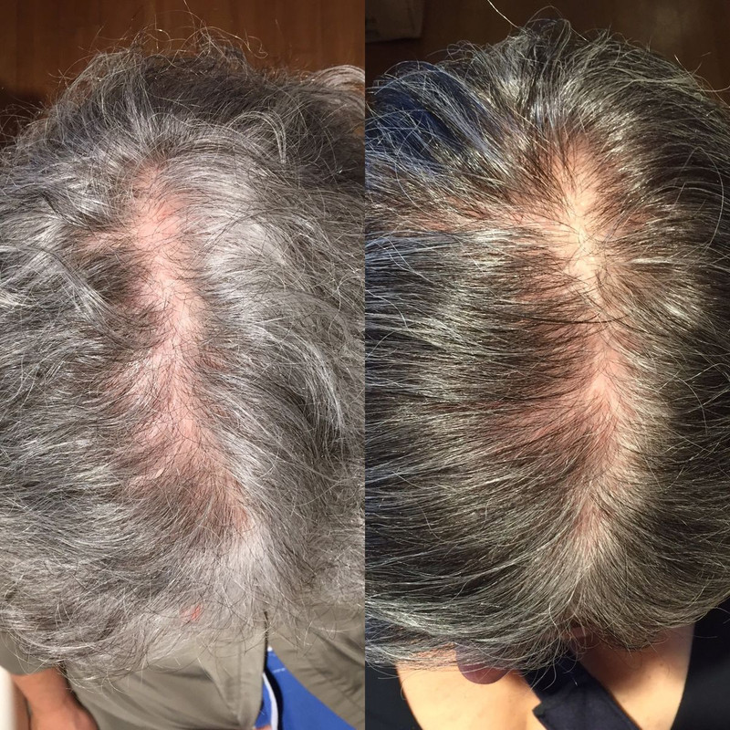 Cambio NovaHair 2