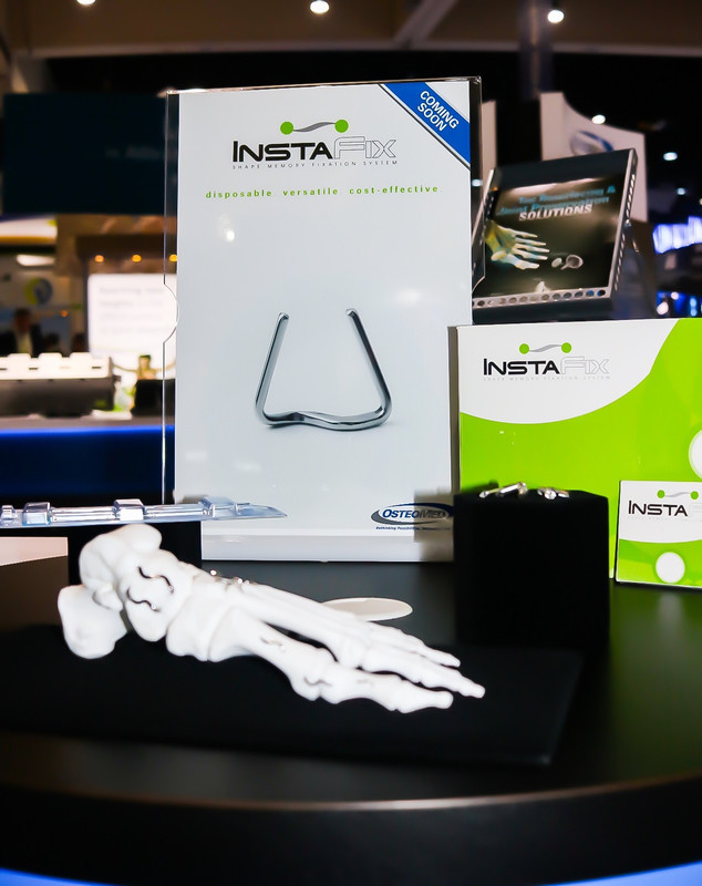 InstaFix Shape Memory Fixation System - nitinol bone fixation staple executed by Enri Zhulati at OsteoMed