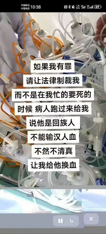 008Ipjo9ly1i2rxhuxdsfj30g50zkjw4