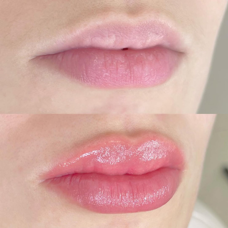 Micropigmentação Labial