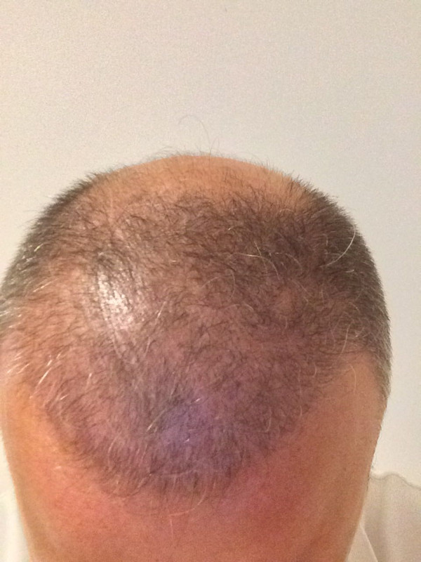 WhatsApp Image 2017-07-17 at 20.52.04