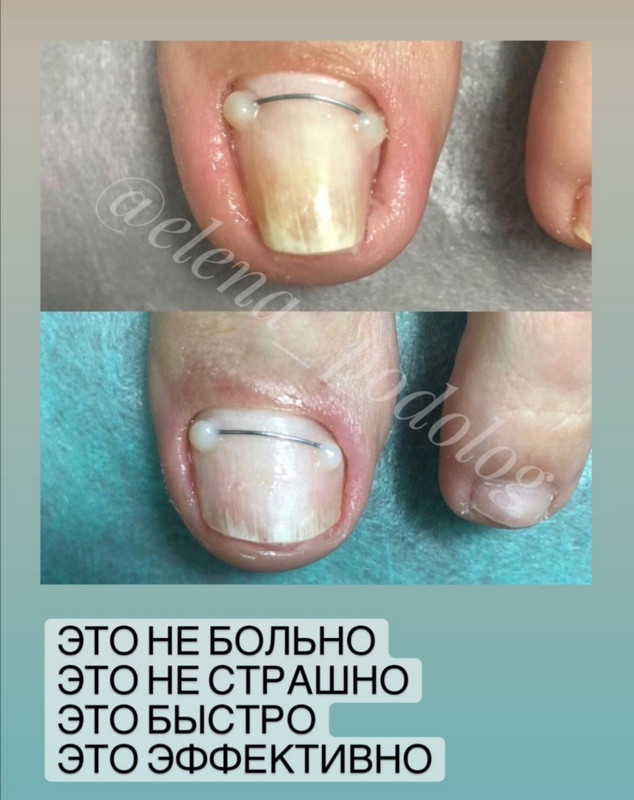 10B7EA9A-7F2E-47E4-8697-6D22E332CC52