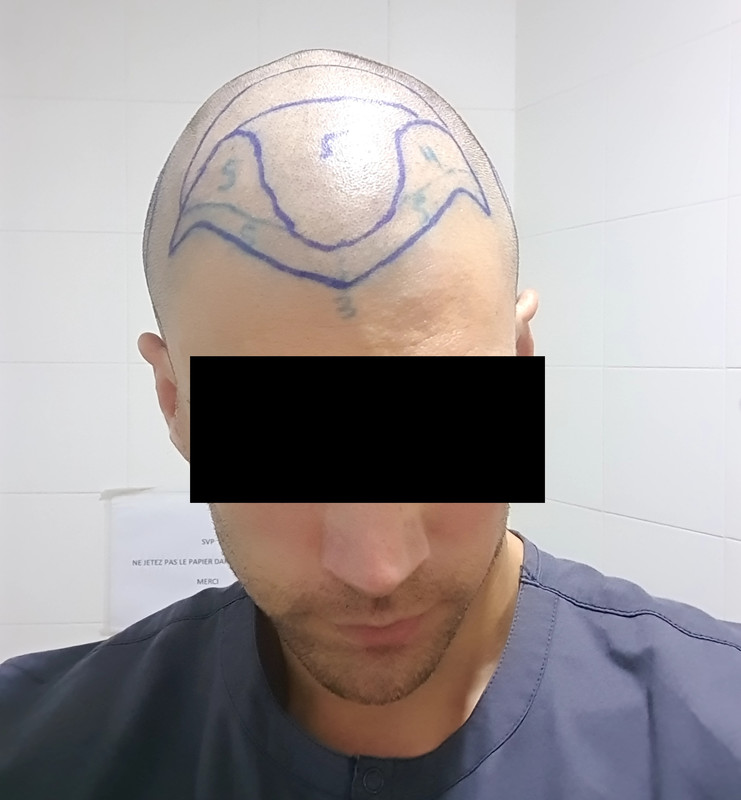 20241014_085051_01 (1)