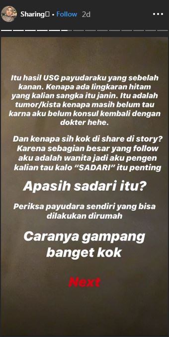 Kesha Ratuliu klarifikasi hasil USG