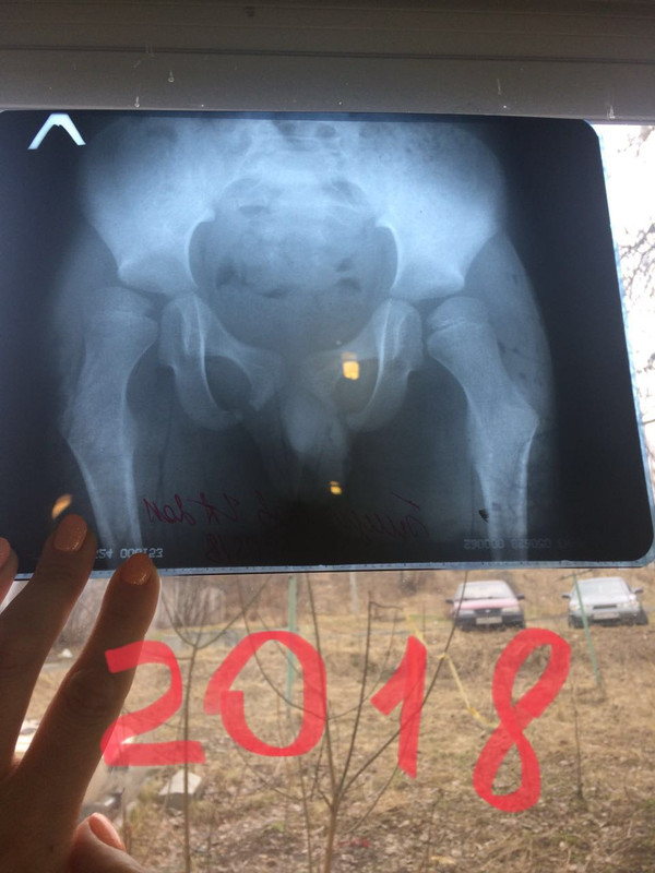 E1BB876F-1BD4-4026-A5DE-D0C84B0A45E2