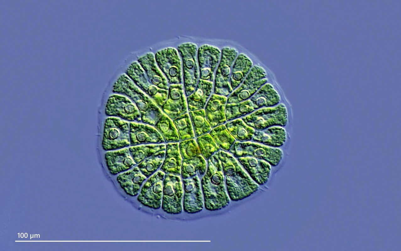 Coleochaete 02 scutata (ev) soluta Dichte Schildalge DIK 100 Stack 3