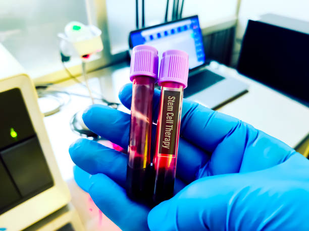 1 best stem cell therapy in Mexico (4)