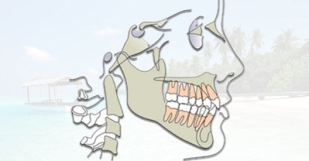 Orthodontic Treatment Planning for dental professionals