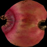 Pomegranate-Albedo
