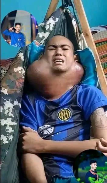 Nepal child condition