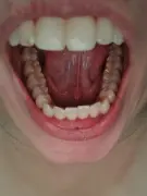 6-years-searching-for-diagnosis-just-found-multiple-v0-t9jjbv91xyod1