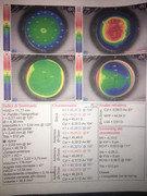 Occhio_destro_prima_operazione