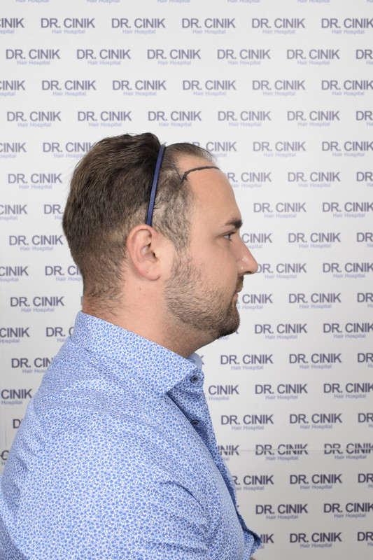 photos préopératoires (5)