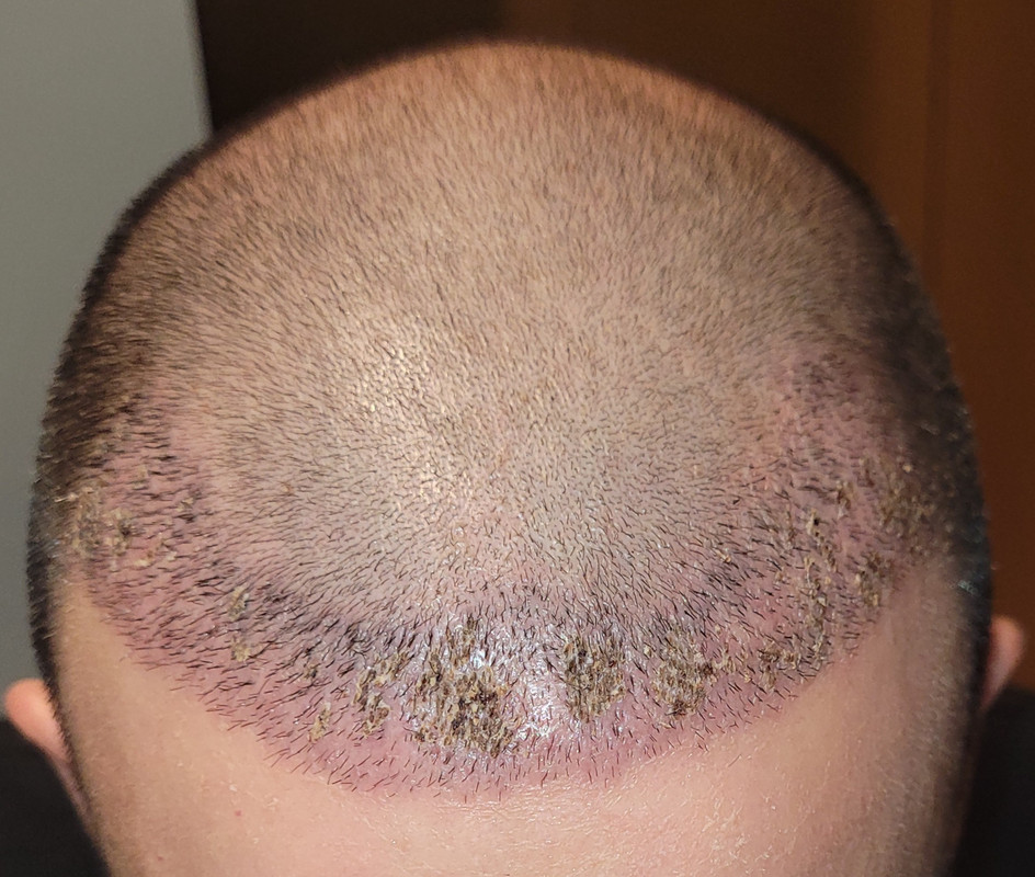 frontal 10