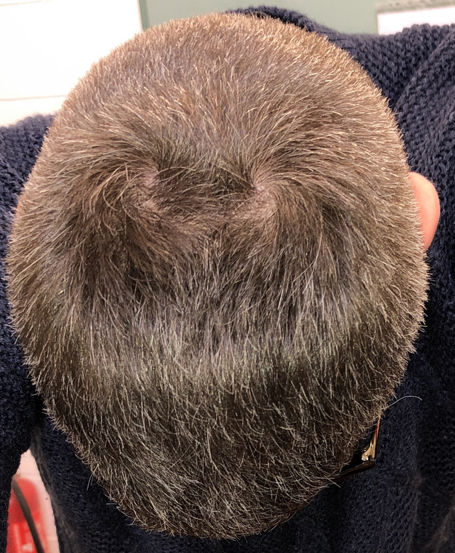 0E4CE87D-FD5A-429E-B49D-78FD44D2C264