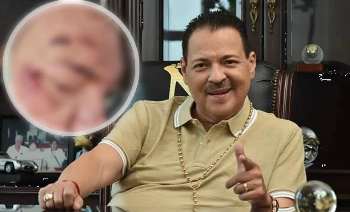 Julio Preciado sufre fuerte accidente en autobús; alarmantes fotos de sus lesiones