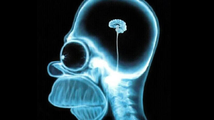 homer-brain-scan