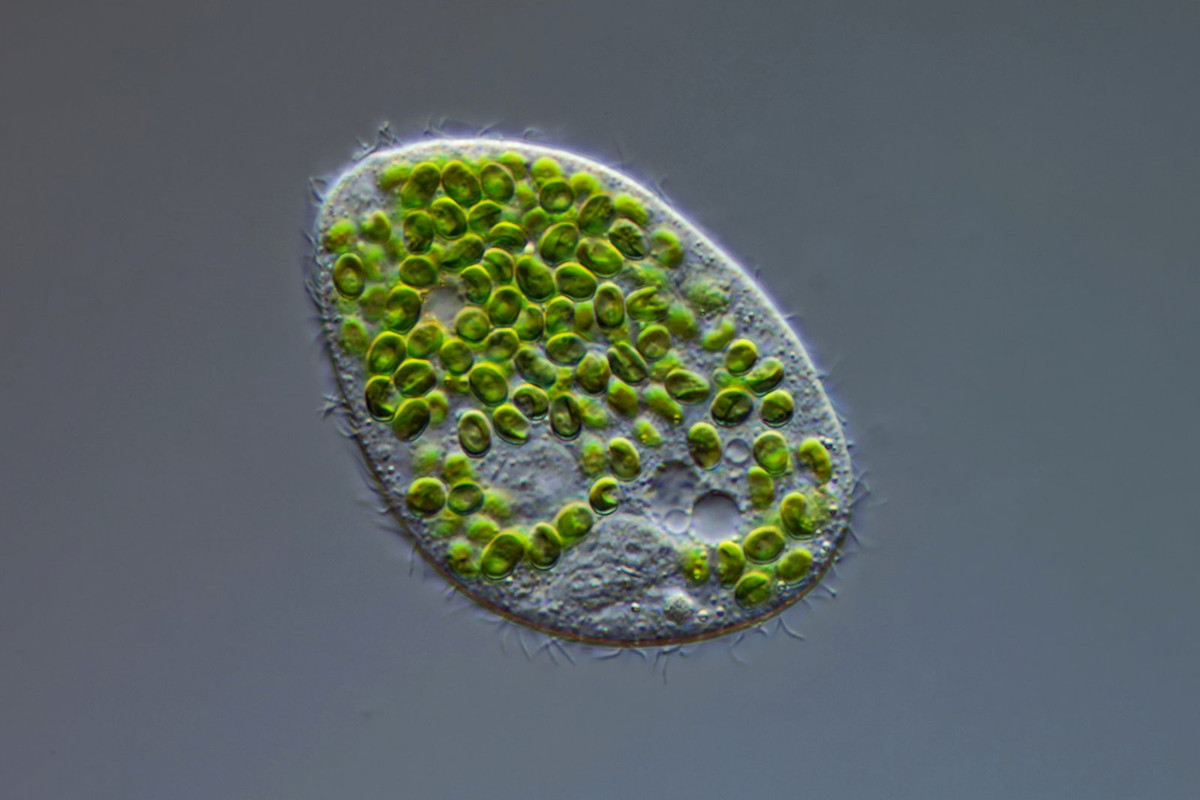 Holophrya 11 (ev) ovum Grüne Zahnwalze Zoochlorellen DIK 100 (Kreutz 175) Bichlersee-Z7