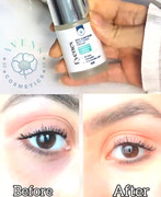 Eyenex Result 4