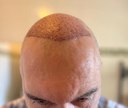 [Imagen: Frontal6.jpg]