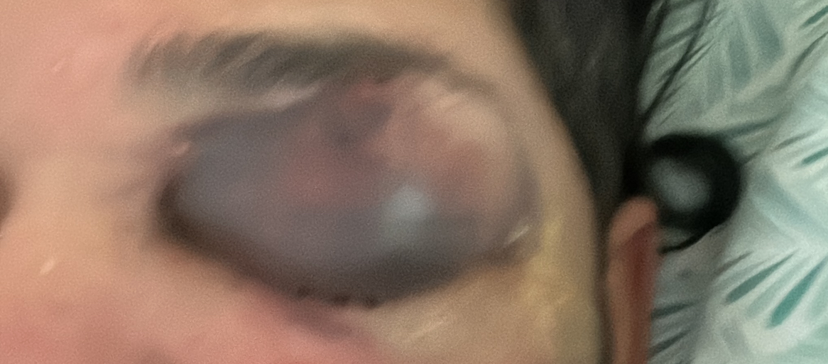 spacer.png