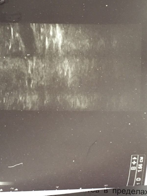 CC027D6D-EA4F-4043-9440-94AB5493FCF3