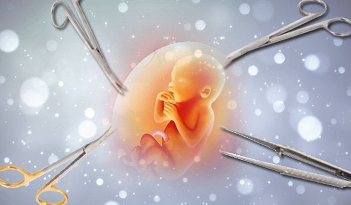 Polisi Bongkar Praktik Aborsi di Makassar, ASN dan Mahasiswi S2 Berhasil Ditangkap Polisi Bongkar Praktik Aborsi di Makassar, ASN dan Mahasiswi S2 Berhasil Ditangkap