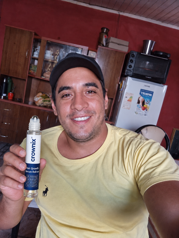 Experiencia de cliente usando Crownix Hair Growth Serum Roll-On