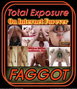 exp total exposure fggt allinone dus