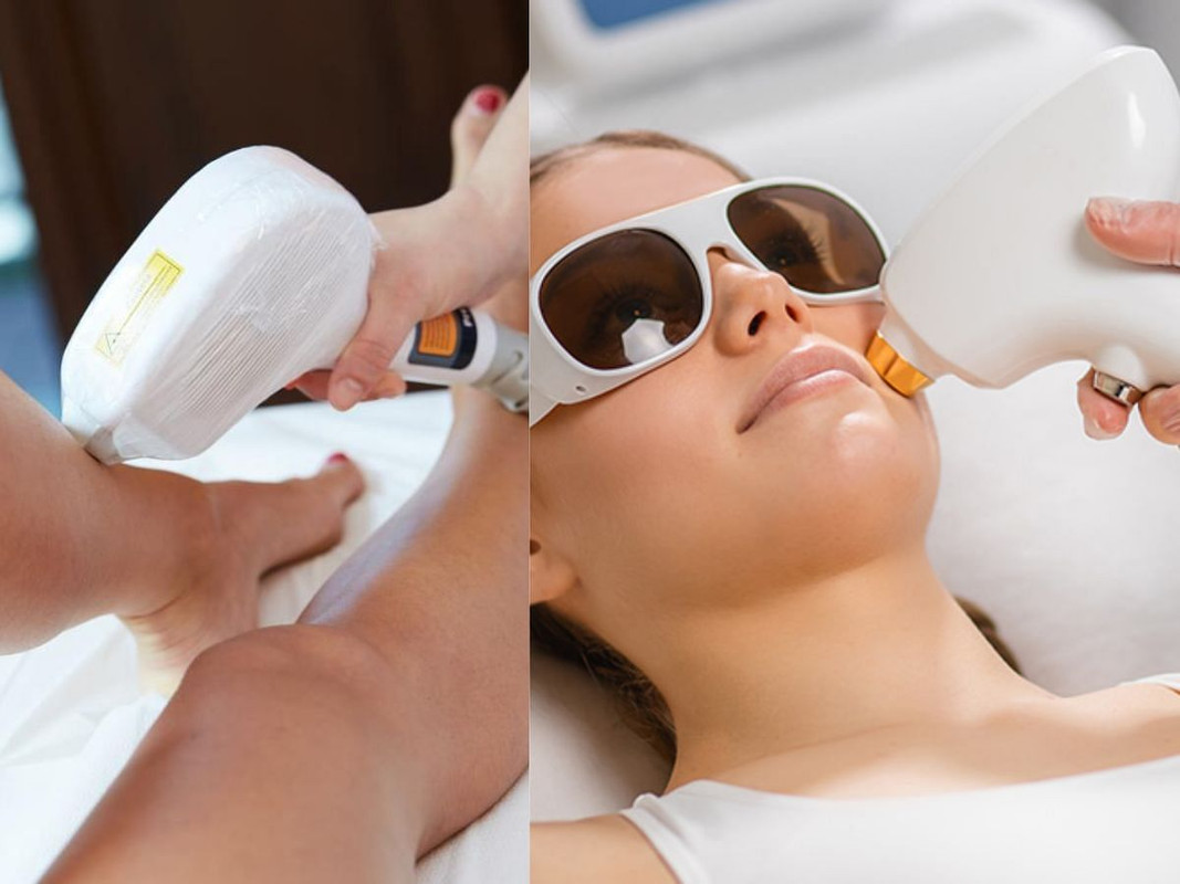 What Is Laser Hair Removal? Everything You Need To Know