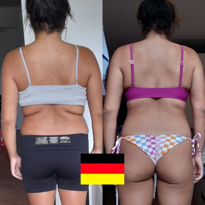 Antes e Depois - Depoimento 9