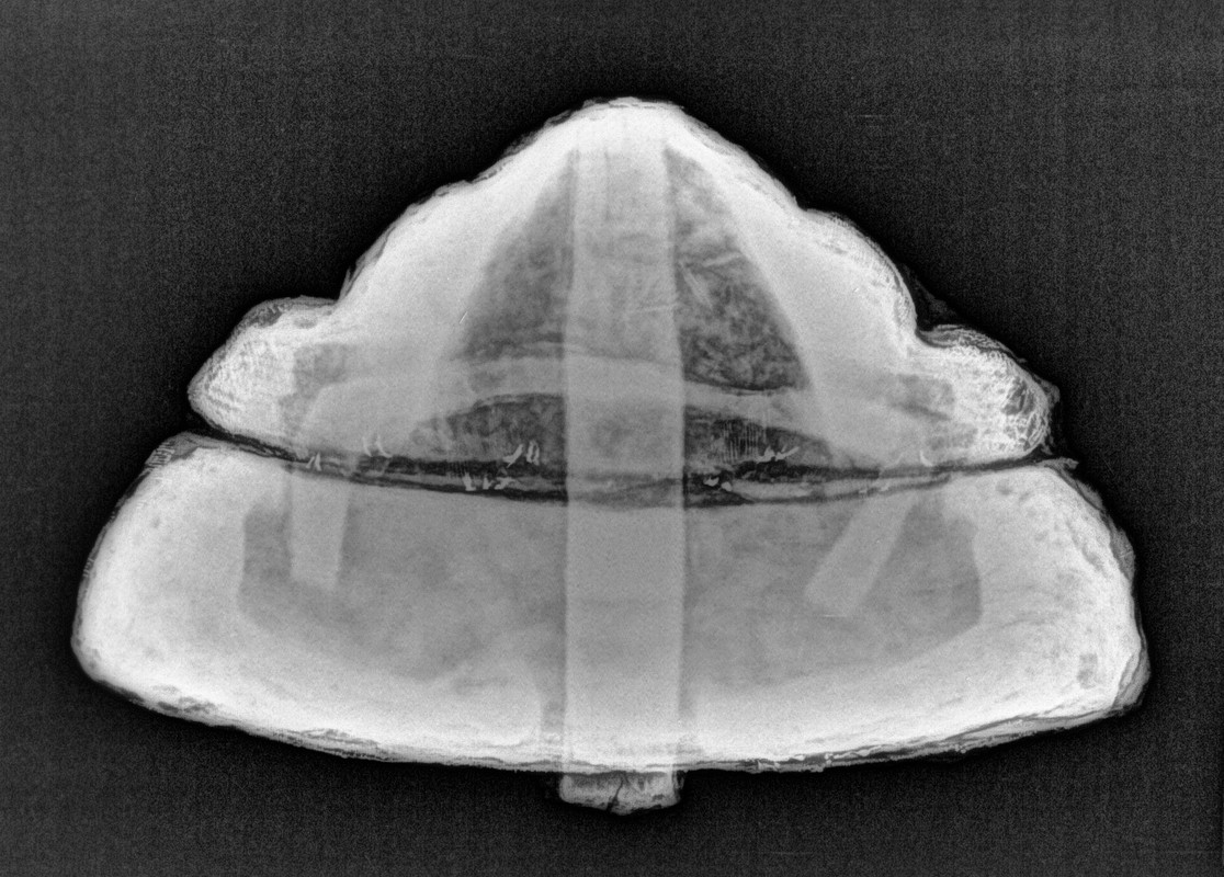 RIPAN PONSI RÖNGTEN