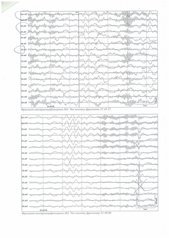 Эхокор стр 4