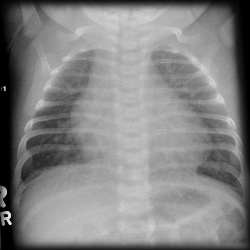 Cardiology question 3 image
